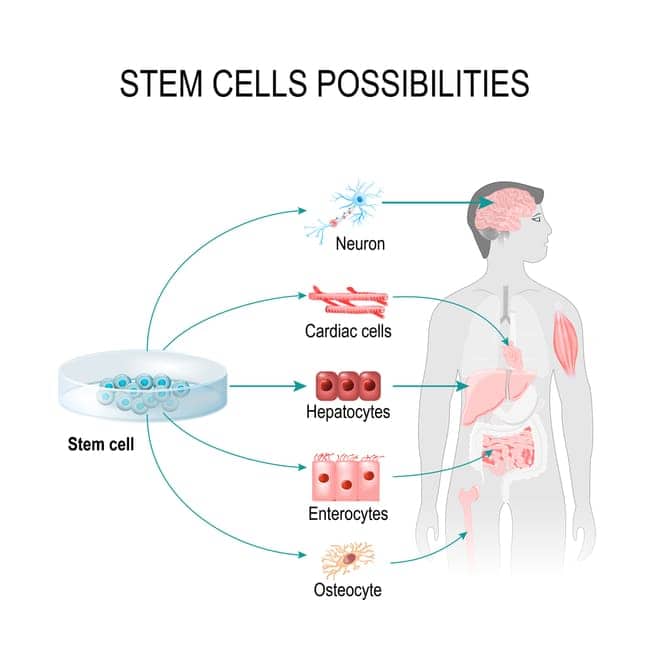 stamceltransplantatie kosten